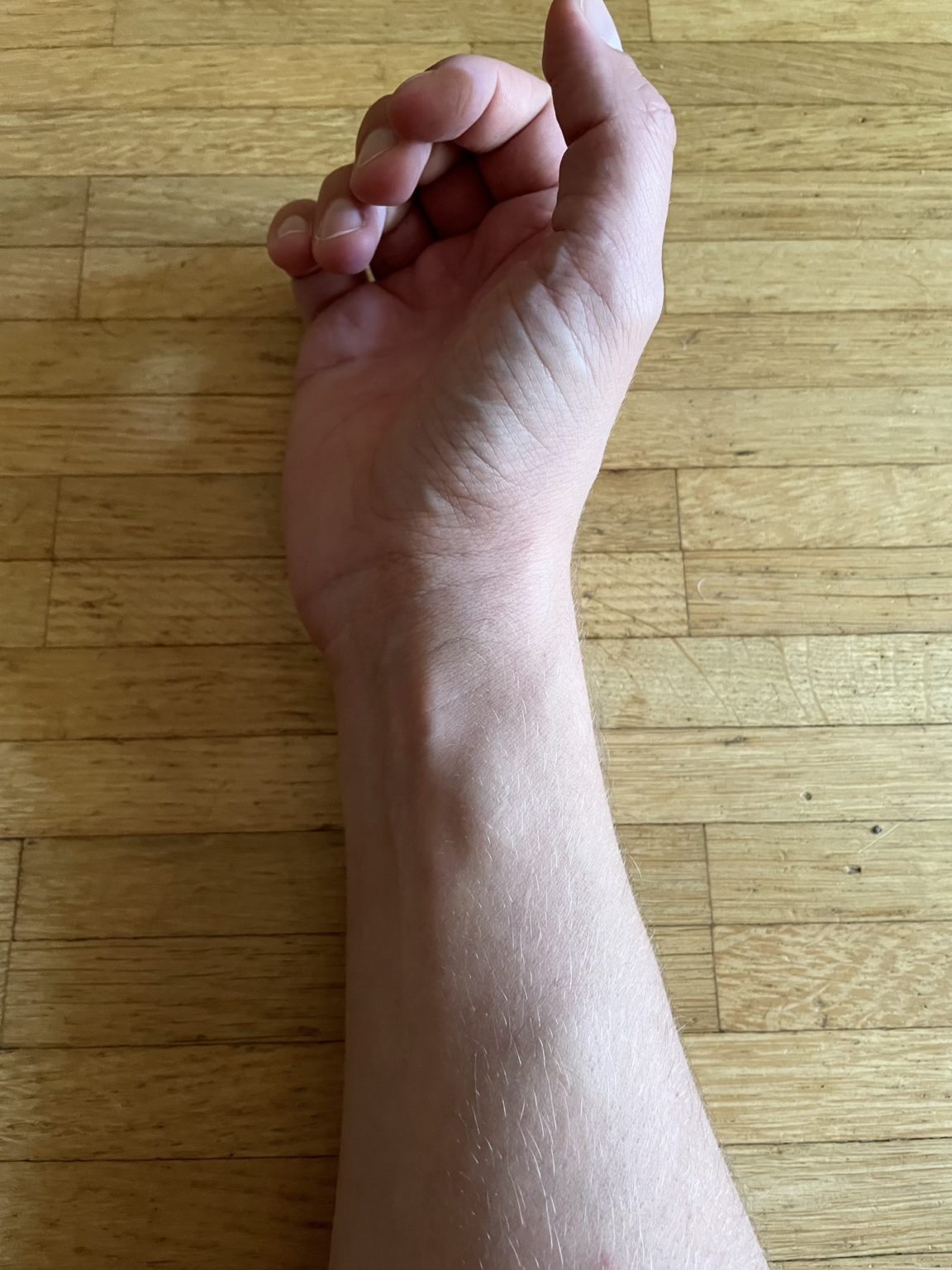 Lipome Bilder - lipome.net